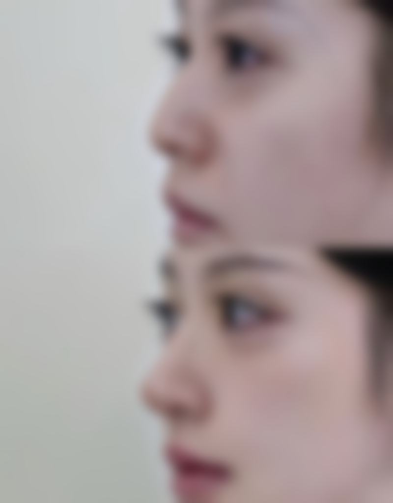 二、赖瑞斌医生擅长项目: