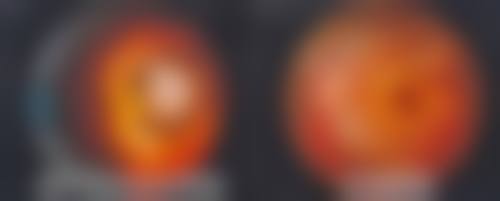 一、林州光明眼科医院怎么样?是眼科诊疗专科医院