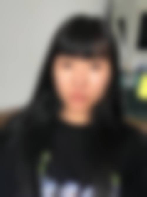 八、硅胶隆鼻的修复期