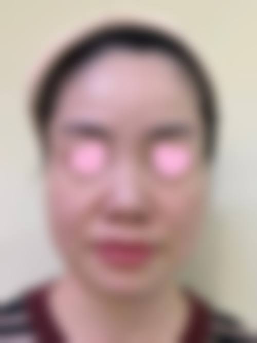 四、茅东升医生收费价格