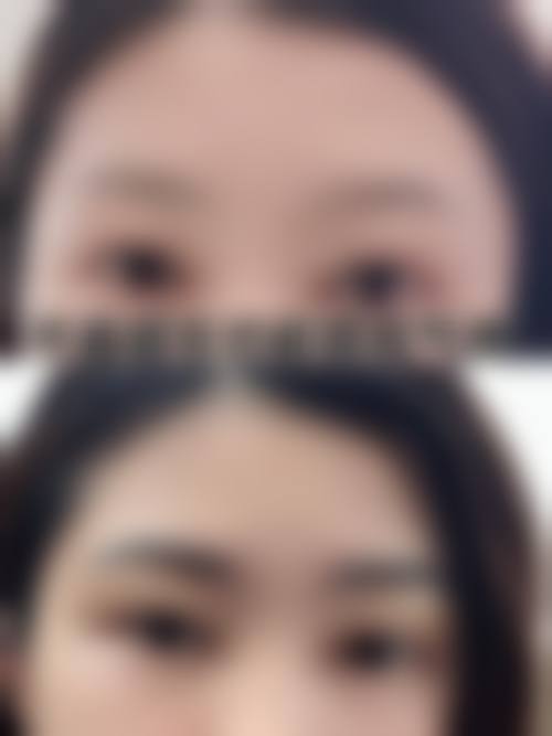 三、韩承烨医生技术水平高: