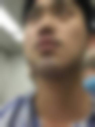 二、韩承烨医生擅长项目: