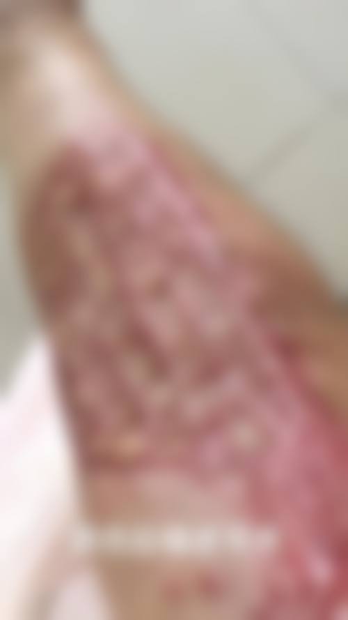 八、患者常见问题解答（精选 ）
