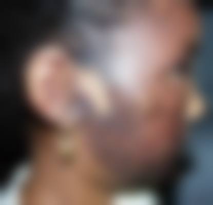 七、咸宁欣妍美颜整形医院口碑如何