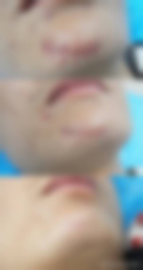 优惠活动详情:限时直降,到院有礼