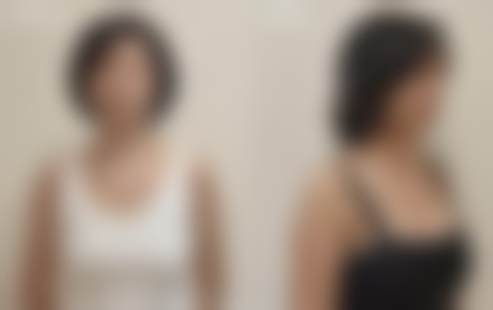三、李有真医生技术水平高