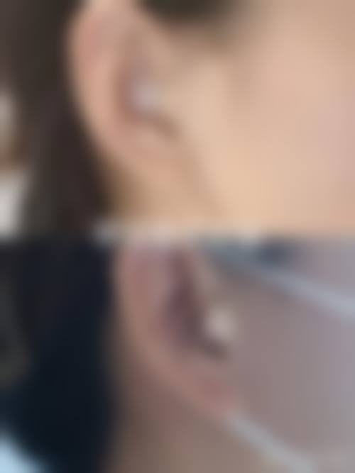 优惠活动详情:限时特别优惠,助力美丽升级