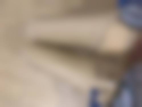 六、腿部抽脂后多久能消肿