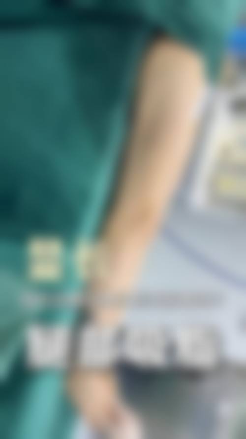 三、不同阶段的成效呈现