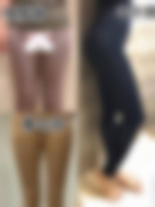 七、腿部抽脂适合人群判断