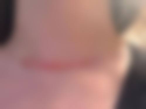 七、潍坊益都中 心医院烧伤整形外科就诊预约挂号指南