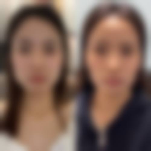 二、许昌明辉丹娜医疗美容门诊部重点开展项目