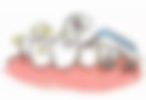 深圳佳美口腔可以刷香港卡嗎 医生推荐:正畸/种植边个医生更掂?