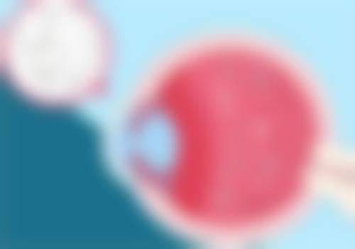 二、斜视眼手术风险大不大?