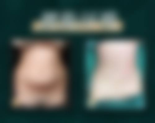 治疗流程