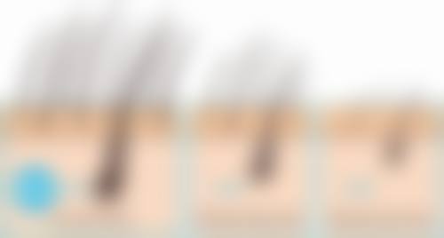 I LIKE整形医院口碑如何?来看患者真实评价