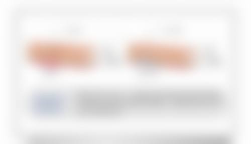 结语:选择正规医美,开启美丽蜕变