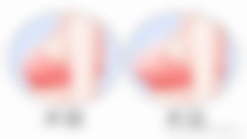 I LIKE整形医院患者常见问题解答(精选 )