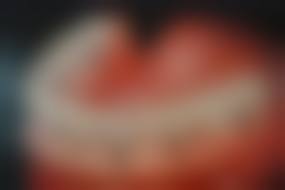 口腔项目优惠活动详情