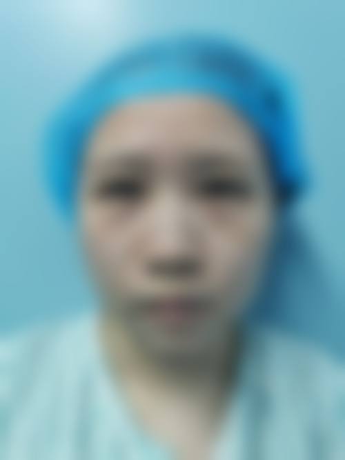 五、去眼袋有什么小窍门吗?运动锻炼不可缺