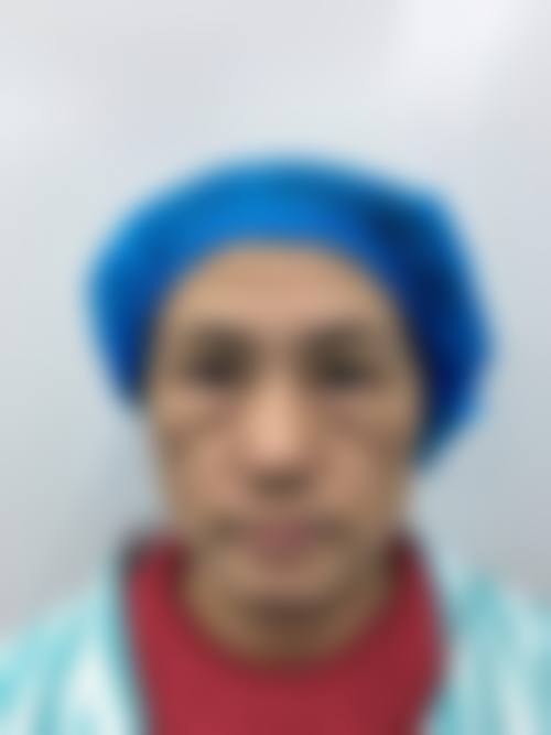 三、去眼袋有什么小窍门吗?护肤品使用不能少