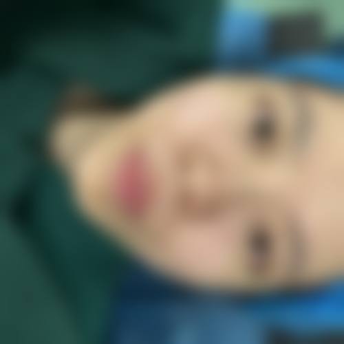 二、去眼袋有什么小窍门吗?物理护理方法特别实用