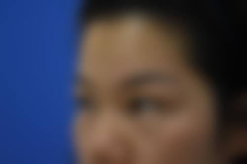 六、去眼袋有什么小窍门吗?医疗美容手段来助力