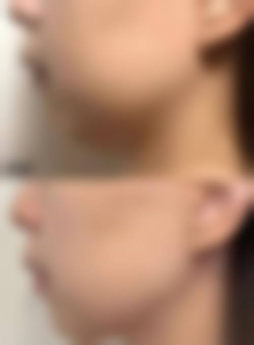 十、患者常见问题解答(精选 )