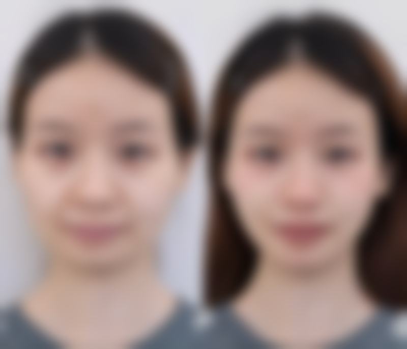 韓國德麗珍TheRegen整形醫院(原高恩世上、奧森博)2026價格表:熱門項目中韓報價大公開