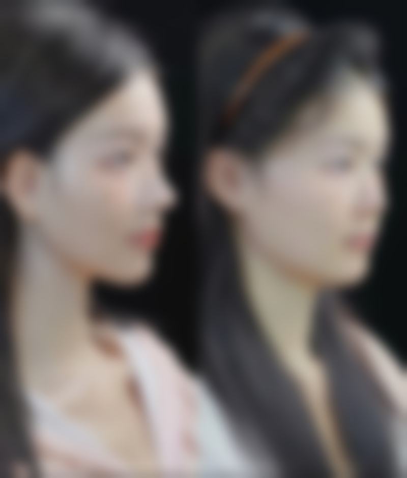 I LIKE整形医院及预约挂号指南