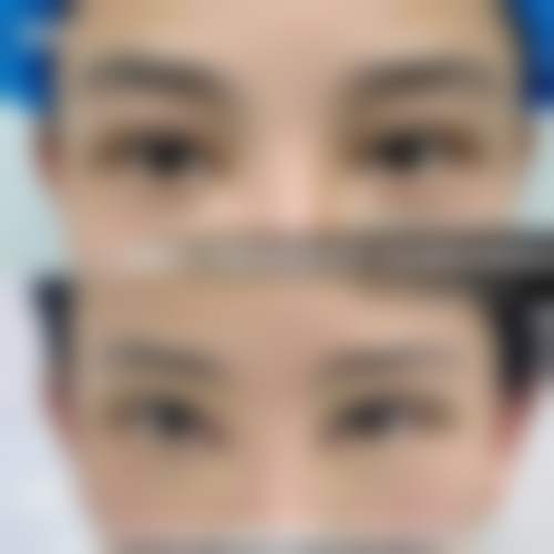 四、王秀伟医生的技术与典型操作流程