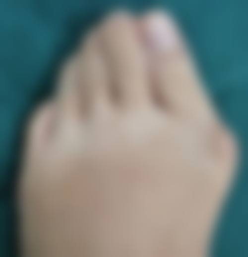 2. 現場掛號唔使愁！朝早6點排隊有實操攻略