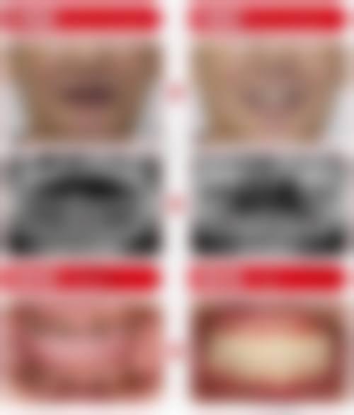 优惠活动详情:原价12800元-优惠价6980元