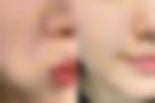立即预约，开启美丽蜕变