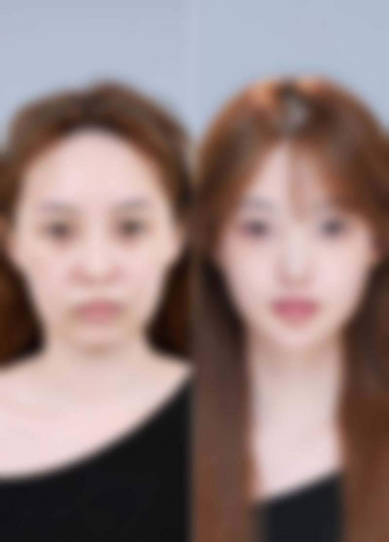 3. 香港大學深圳醫院皮膚科預約 適合邊類人群？同香港本地診所有咩分別？