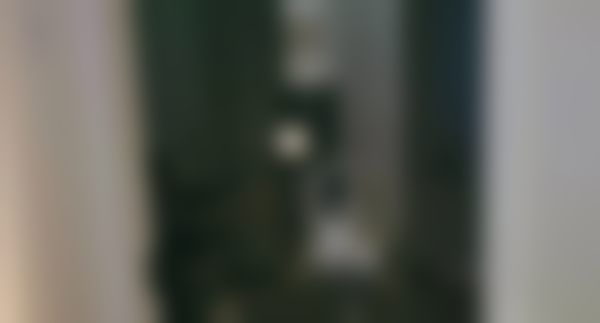 3. 术前检查细到“抠细节”:20多项检查花了1.5小时