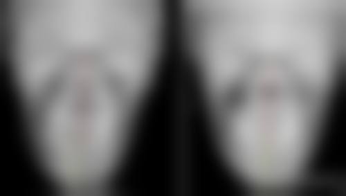 shinebom皮膚科價格表2026中韓報價 適合邊類人群?