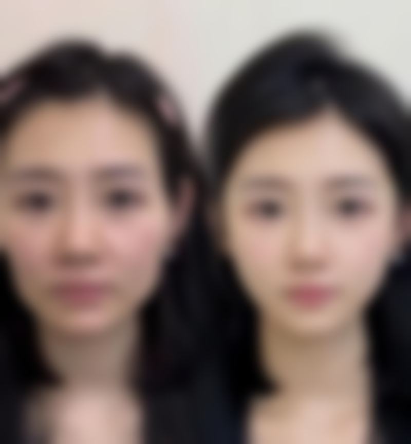 擅长项目详解