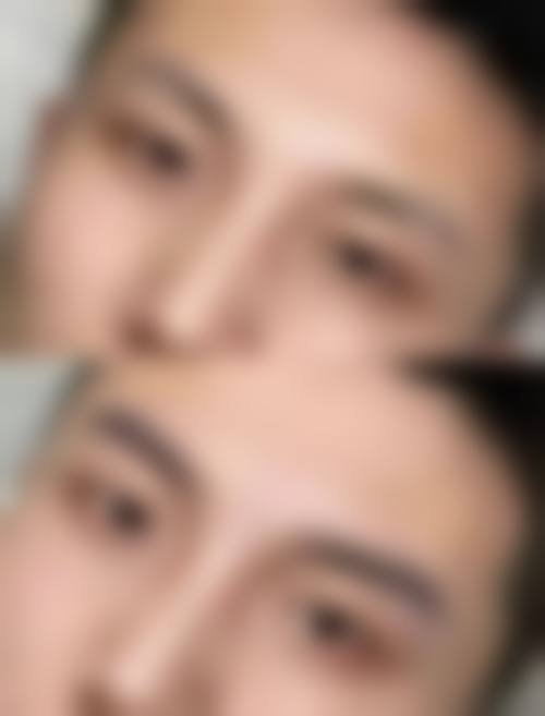 三、涂世全植发医生擅长项目与适合人群