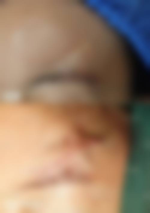 1、主要做的三大诊疗项目