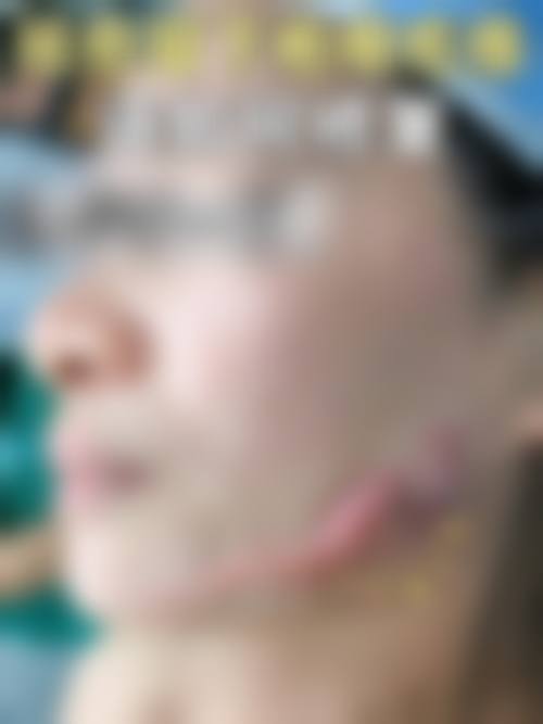 2、【隆鼻】核心技术优势