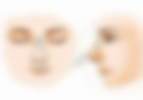 自然款還是美紋術？術後成效大比拼