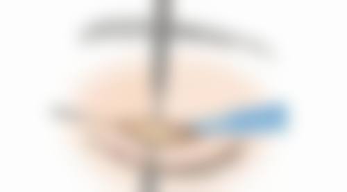 韓國男生雙眼皮推薦自然款 醫生點揀？成鎮模/金敏哲/李相雨邊個啱你？
