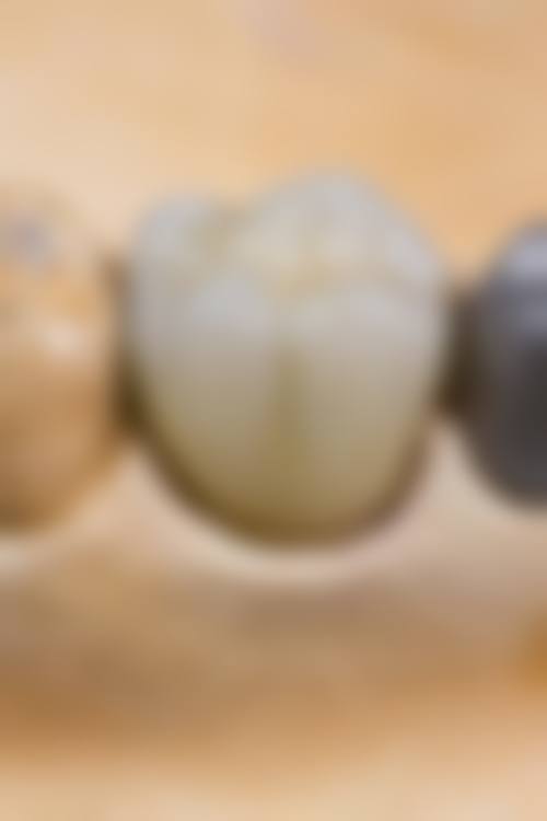 结束语——让专精牙医守护您的口腔健康