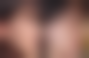 術前術後避坑指南:港澳姊妹必知10件事