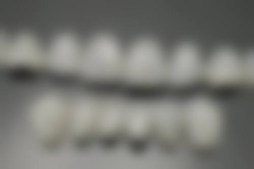 深圳牙科邊間好 真實实例:香港姊妹嘅整牙經歷