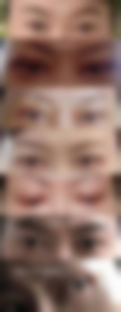 十一、如何选择医院和医生进行德国热熔眼袋技术治疗