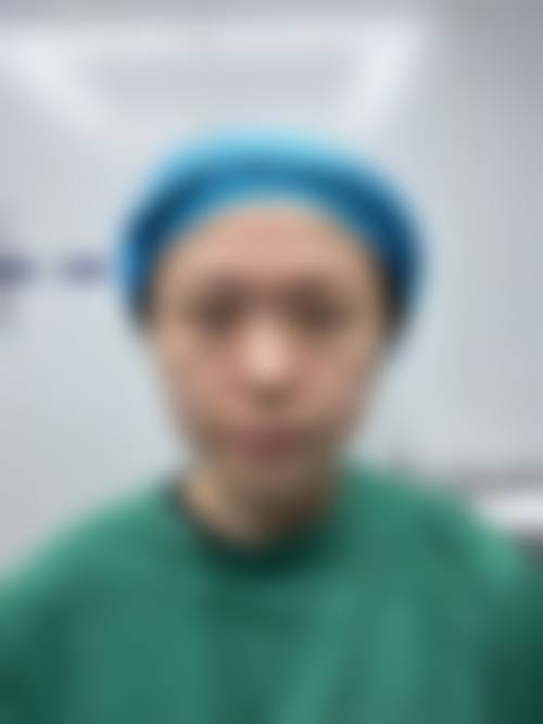 石红卫医生五代大拉皮技术优势
