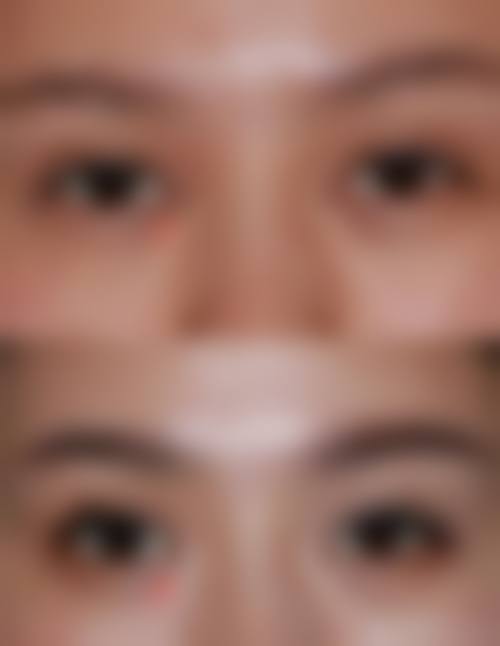 石红卫医生手术成效