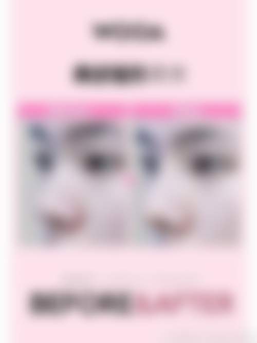 北京博美医疗整形美容医院的医生团队实力如何?